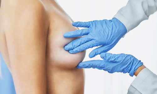 When do you need a Breast Lift Surgery? | Plastic Surgery Indian