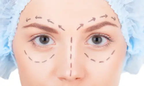Double Eyelid Surgery | Plastic Surgery Indian