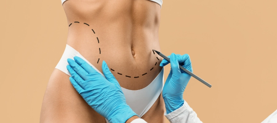 Liposuction | Plastic Surgery Indian