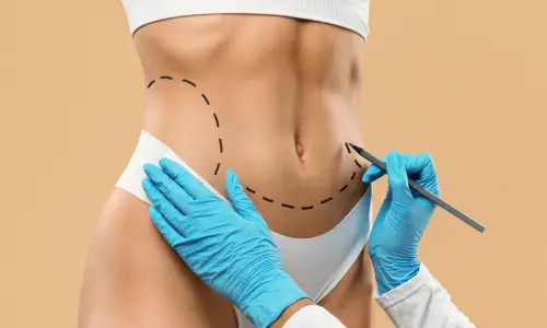 Liposuction | Plastic Surgery Indian