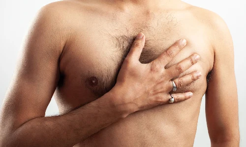 When do you need Male Breast Reduction Surgery? | Plastic Surgery Indian