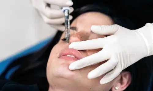 Lip Fillers | Plastic Surgery Indian