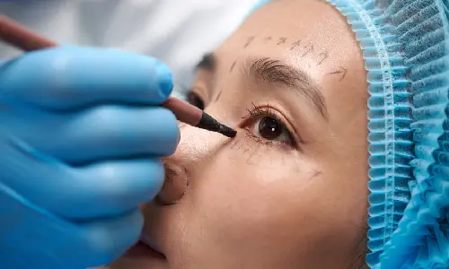 Ptosis Surgery | Plastic Surgery Indian