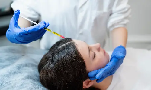 GFC for Hair Regrowth | Plastic Surgery India