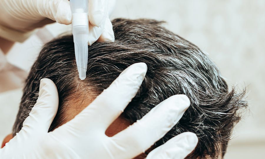 Hair Transplant | Plastic Surgery India 